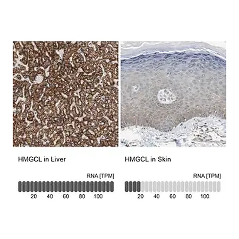 Merck Anti-HMGCL antibody produced in rabbit