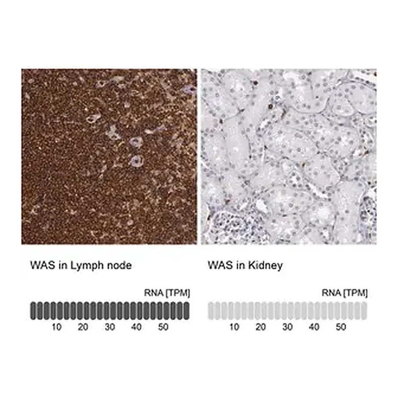 Merck Anti-WAS antibody produced in rabbit