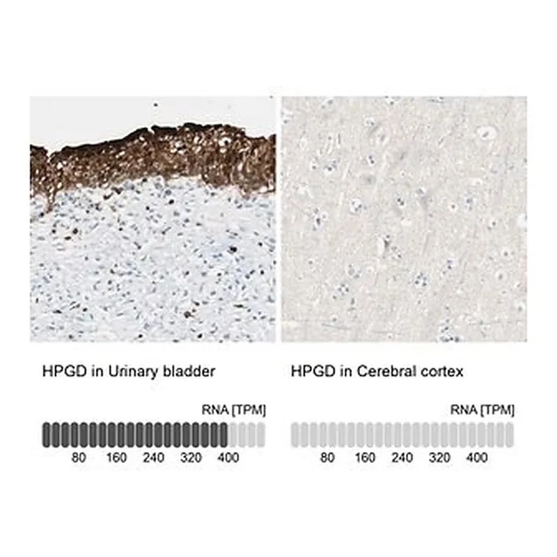 Merck Anti-HPGD antibody produced in rabbit
