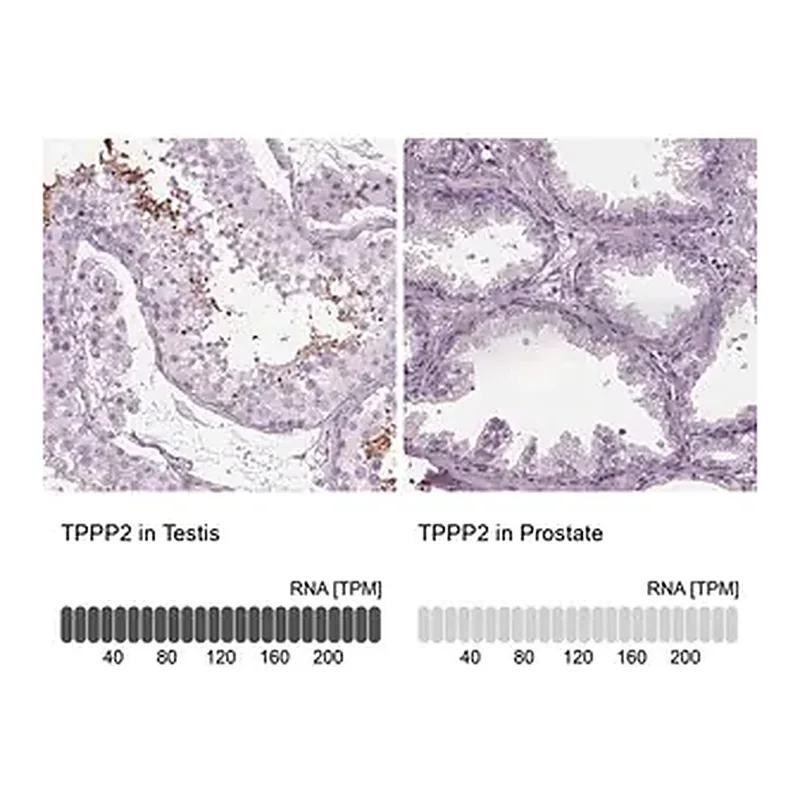 Merck Anti-TPPP2 antibody produced in rabbit