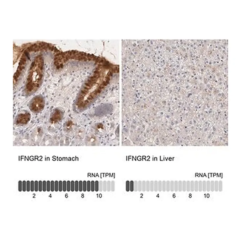 Merck Anti-IFNGR2 antibody produced in rabbit