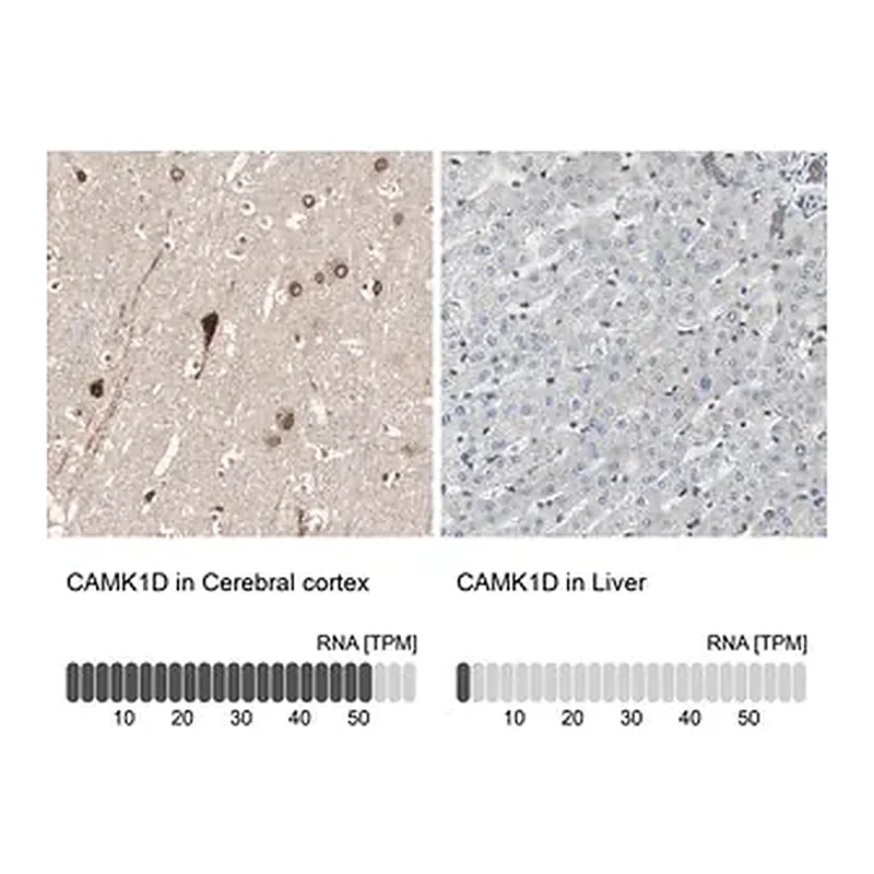 Merck Anti-CAMK1D antibody produced in rabbit