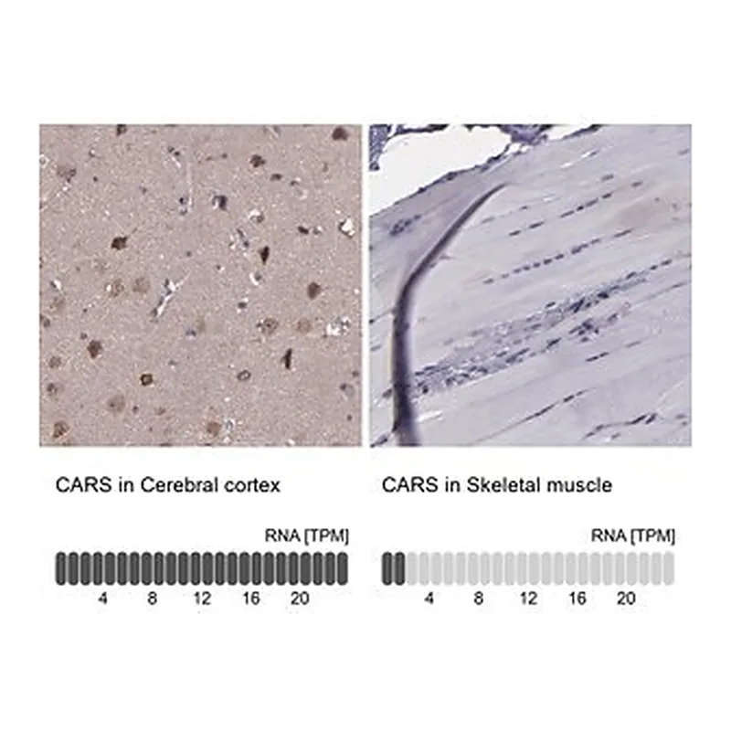 Merck Anti-CARS antibody produced in rabbit