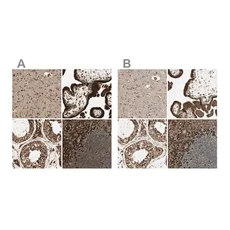 Merck Anti-CANX antibody produced in rabbit