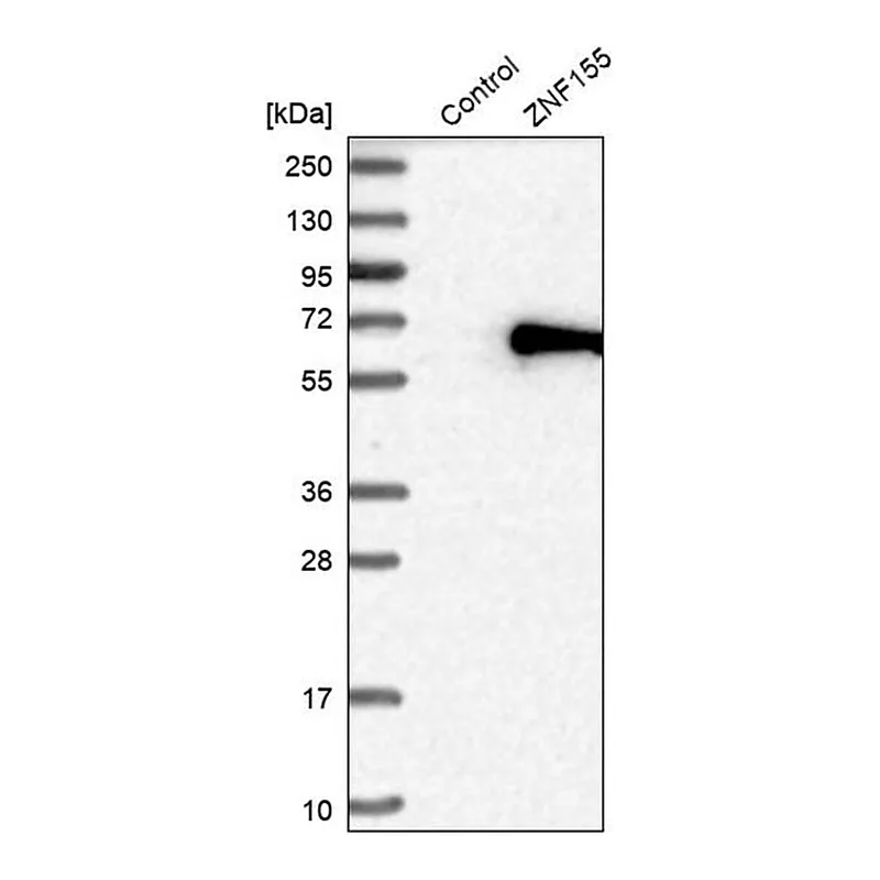 Merck Anti-ZNF155 antibody produced in rabbit