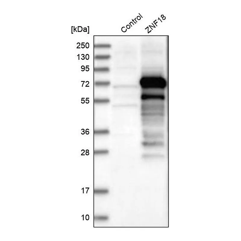 Merck Anti-ZNF18 antibody produced in rabbit