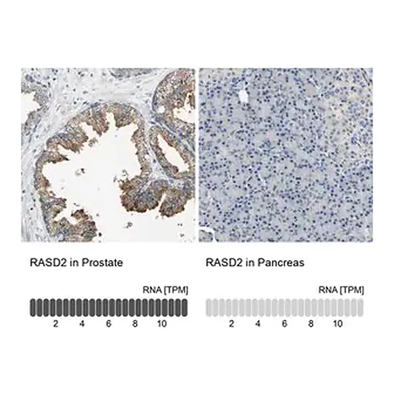Merck Anti-RASD2 antibody produced in rabbit