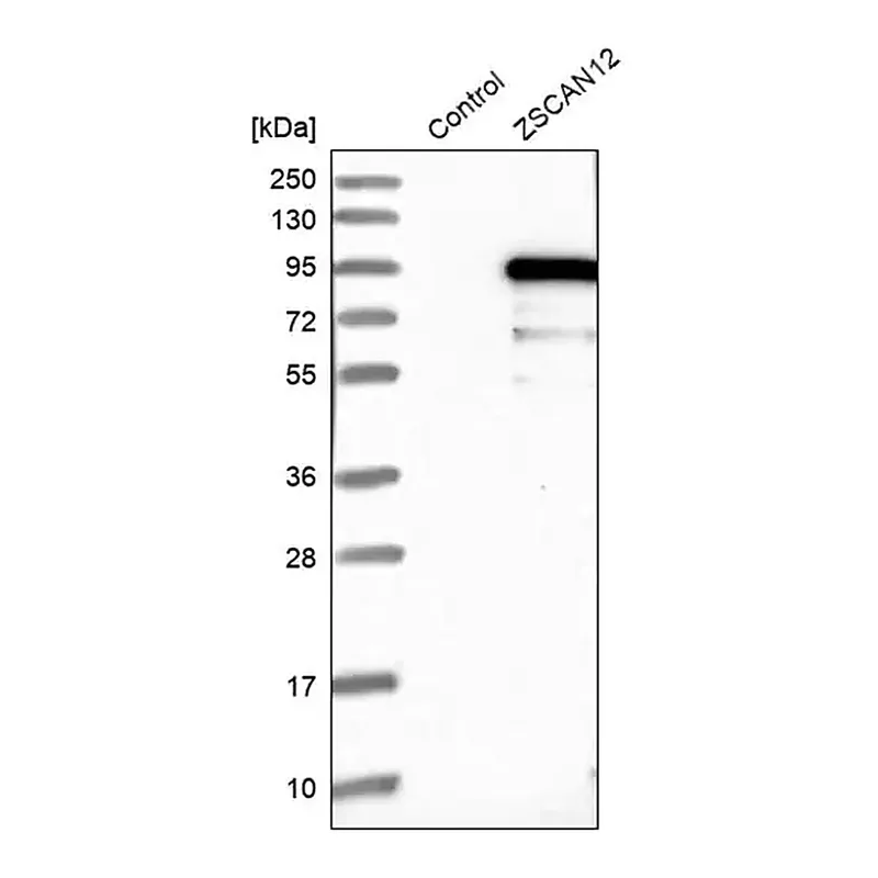 Merck Anti-ZSCAN12 antibody produced in rabbit