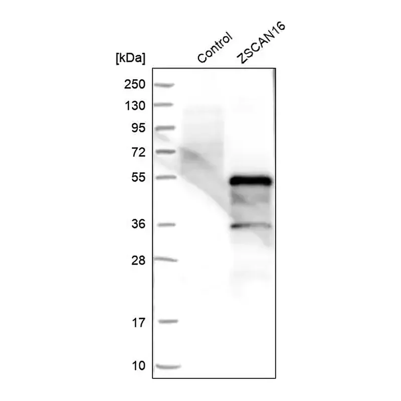 Merck Anti-ZSCAN16 antibody produced in rabbit