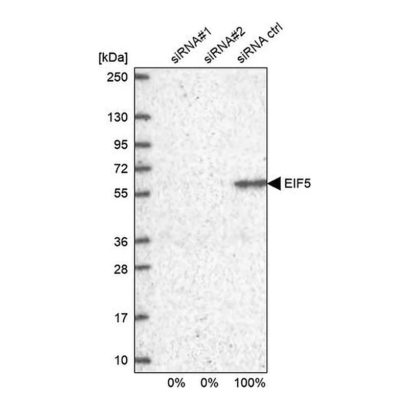 Merck Anti-EIF5 antibody produced in rabbit
