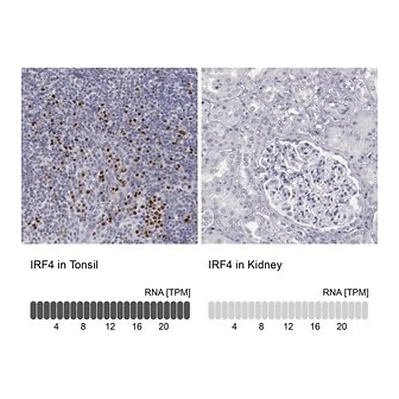 Merck Anti-IRF4 antibody produced in rabbit