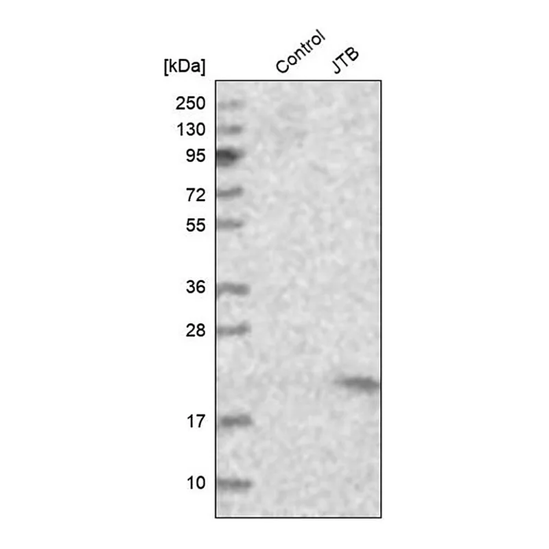 Merck Anti-JTB antibody produced in rabbit