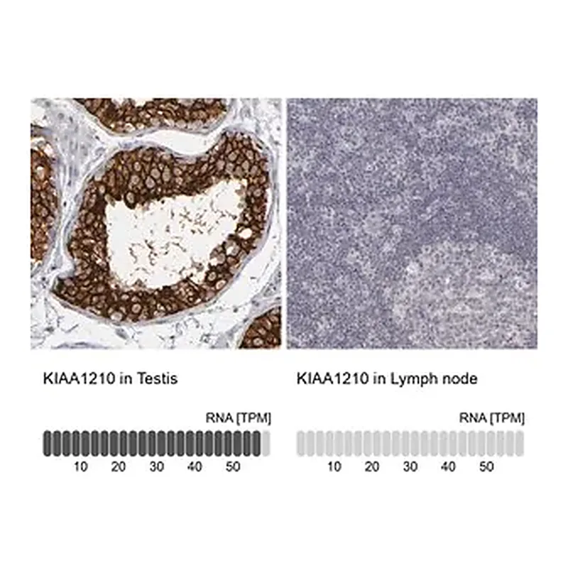 Merck Anti-KIAA1210 antibody produced in rabbit