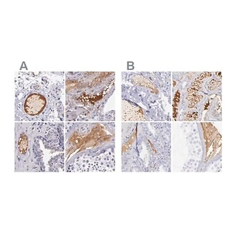 Merck Anti-KNG1 antibody produced in rabbit