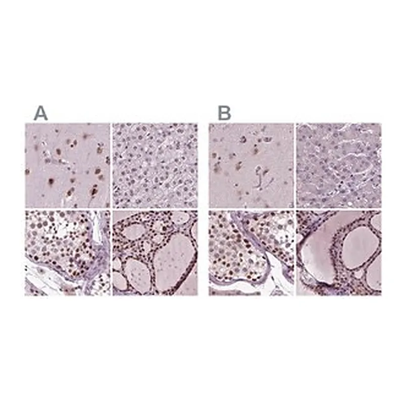 Merck Anti-RCOR3 antibody produced in rabbit