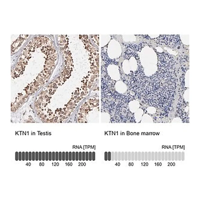 Merck Anti-KTN1 antibody produced in rabbit