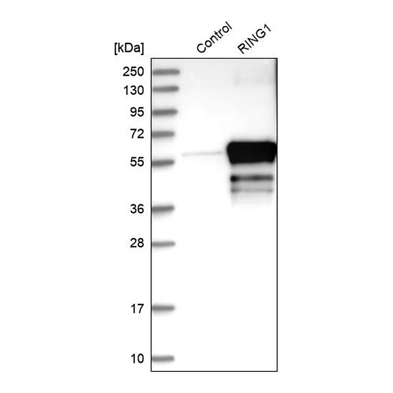 Merck Anti-RING1 antibody produced in rabbit