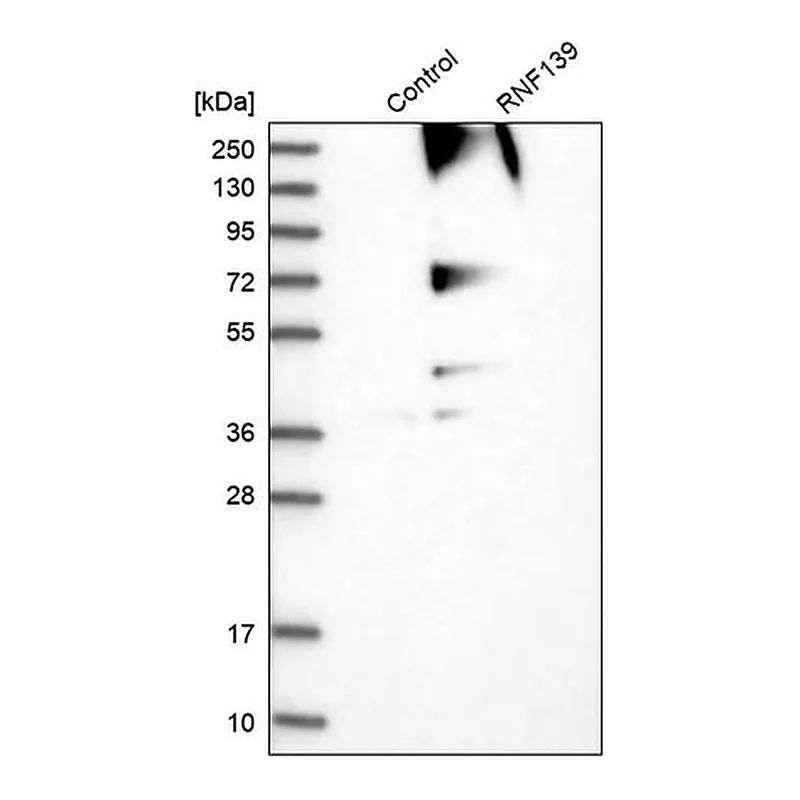 Merck Anti-RNF139 antibody produced in rabbit