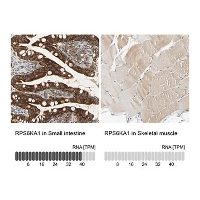 Merck Anti-RPS6KA1 antibody produced in rabbit