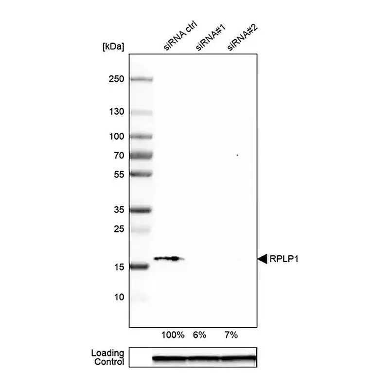Merck Anti-RPLP1 antibody produced in rabbit