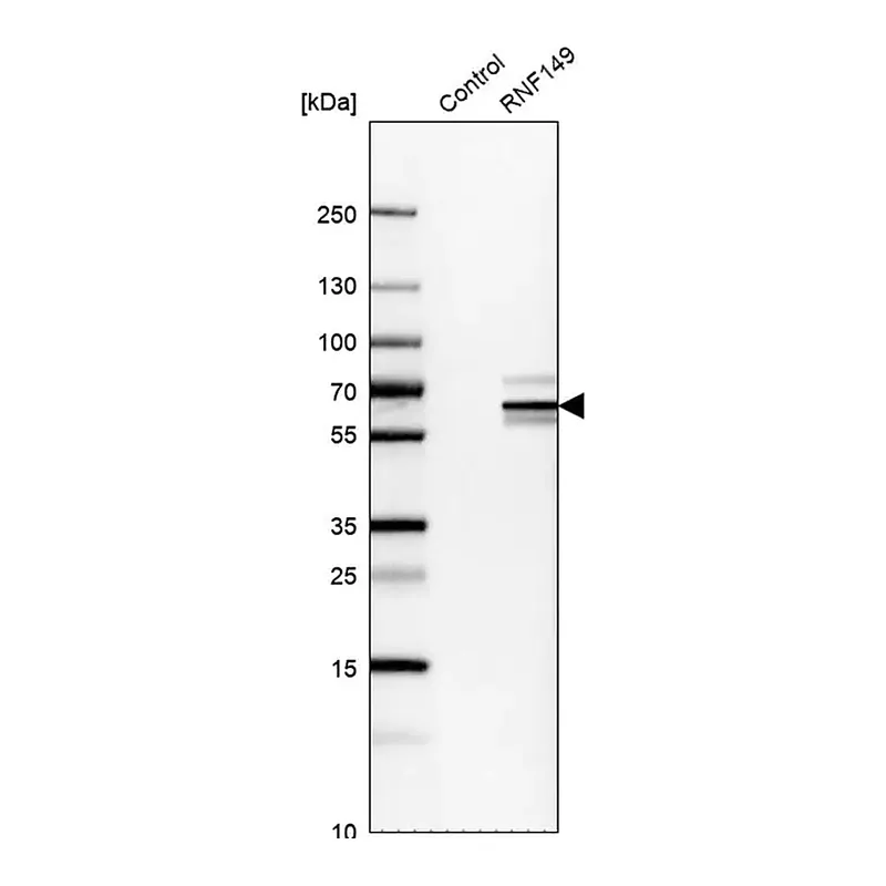 Merck Anti-RNF149 antibody produced in rabbit