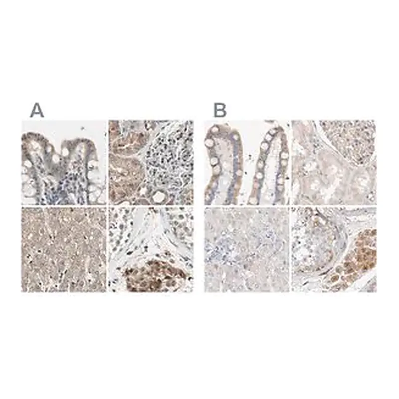 Merck Anti-PROS1 antibody produced in rabbit
