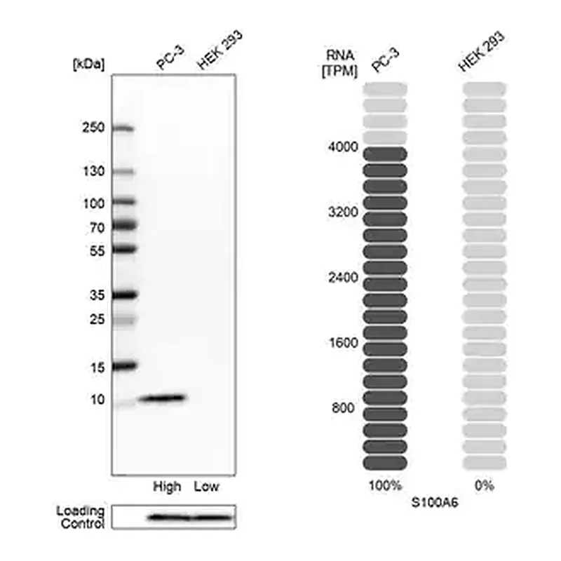 Merck Anti-S100A6 antibody produced in rabbit