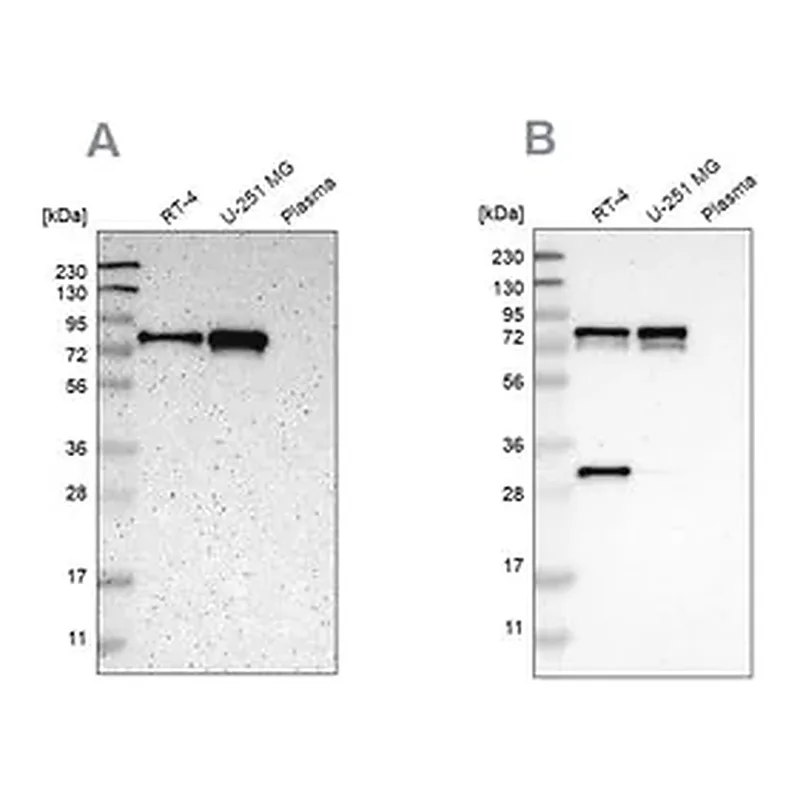 Merck Anti-MTDH antibody produced in rabbit