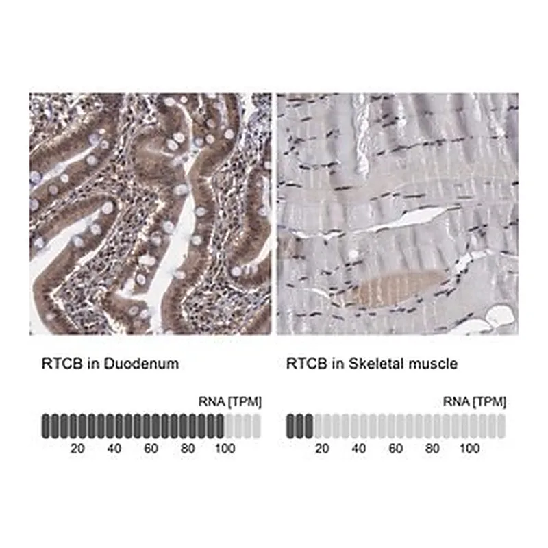 Merck Anti-RTCB antibody produced in rabbit