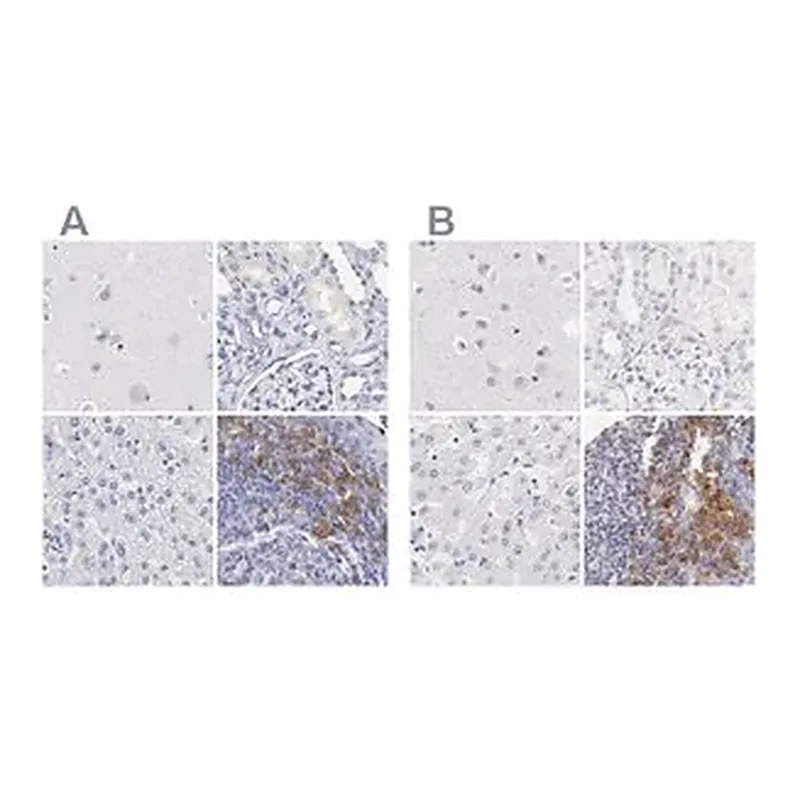 Merck Anti-LAX1 antibody produced in rabbit