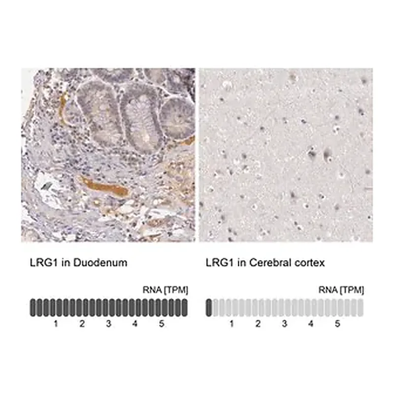 Merck Anti-LRG1 antibody produced in rabbit