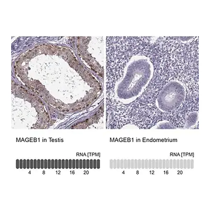 Merck ANTI-MAGEB1 antibody produced in rabbit