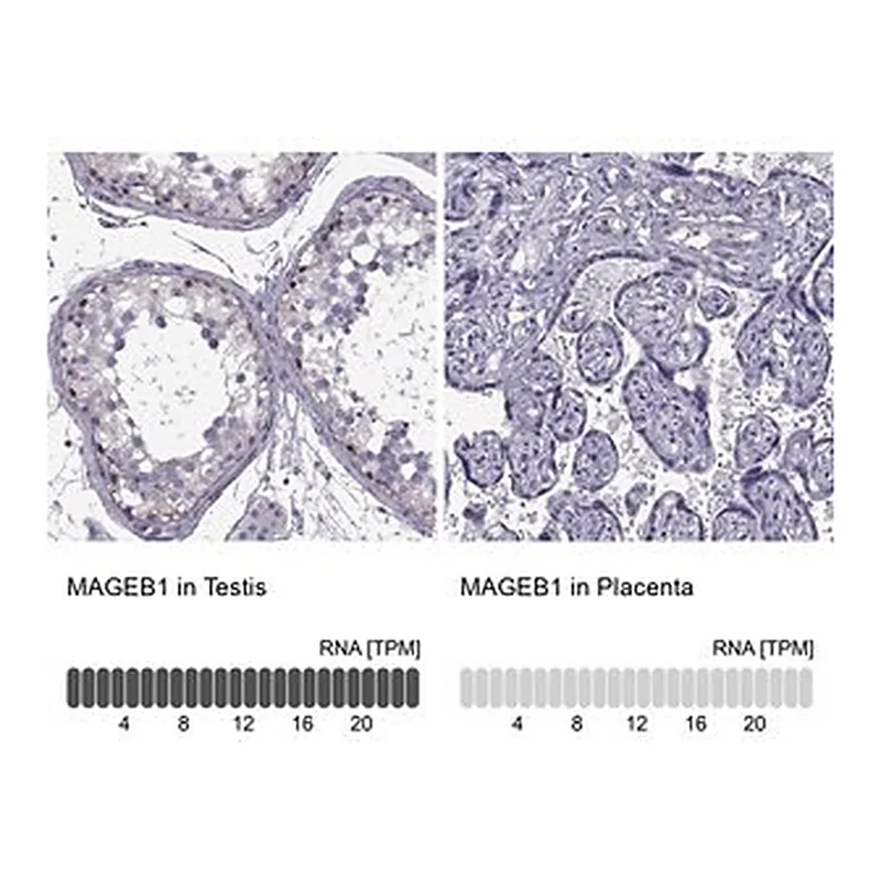 Merck ANTI-MAGEB1 antibody produced in rabbit