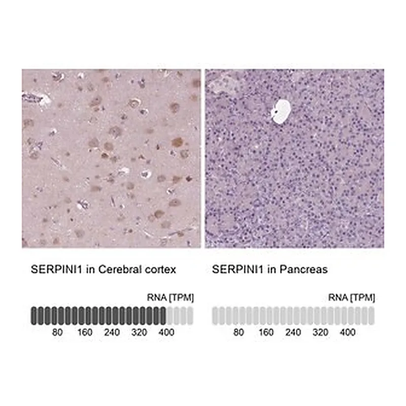 Merck Anti-SERPINI1 antibody produced in rabbit