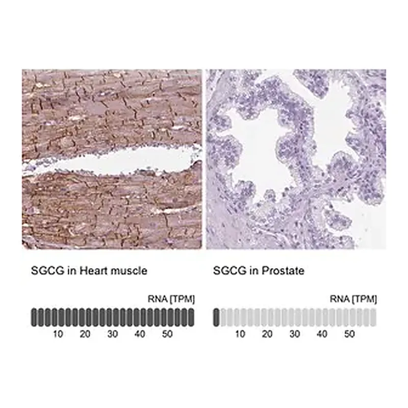 Merck Anti-SGCG antibody produced in rabbit