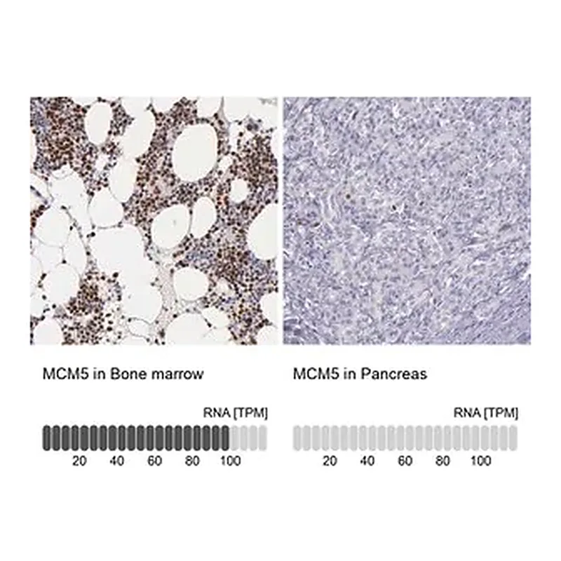 Merck Anti-MCM5 antibody produced in rabbit