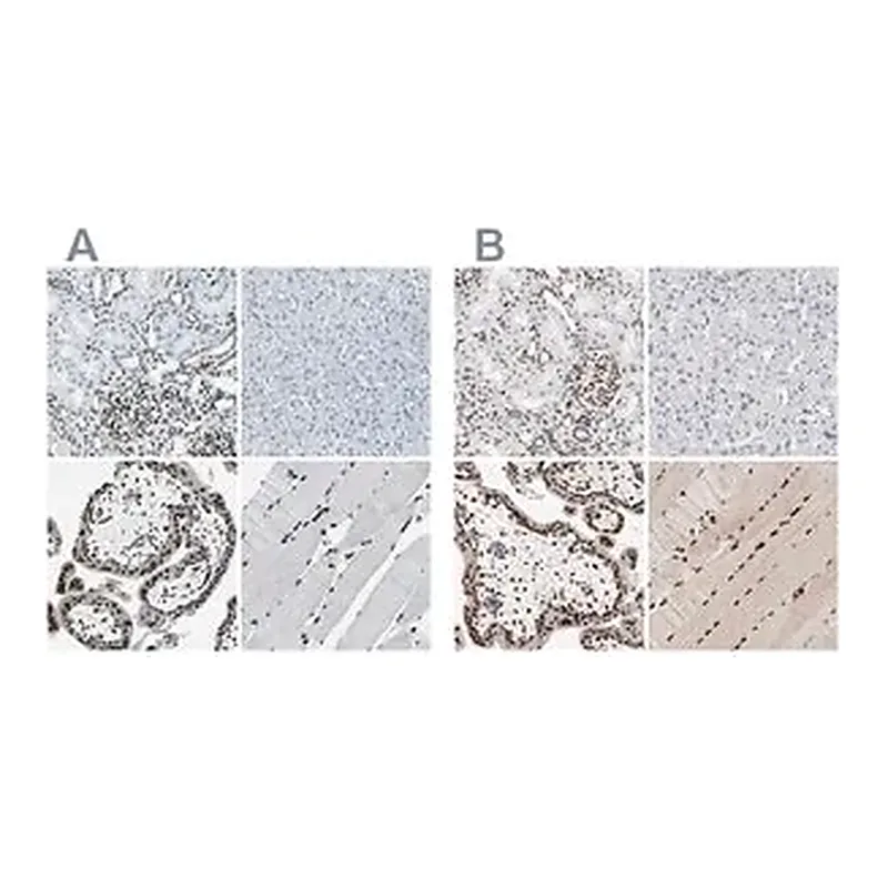 Merck Anti-MEF2D antibody produced in rabbit