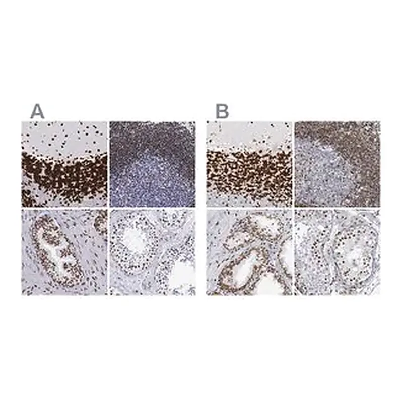 Merck Anti-MECP2 antibody produced in rabbit