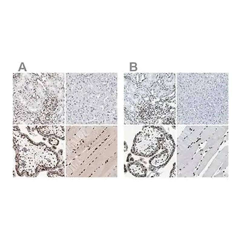 Merck Anti-MEF2D antibody produced in rabbit