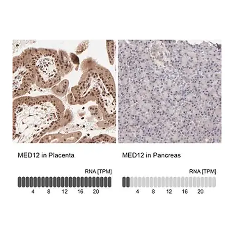 Merck Anti-MED12 antibody produced in rabbit