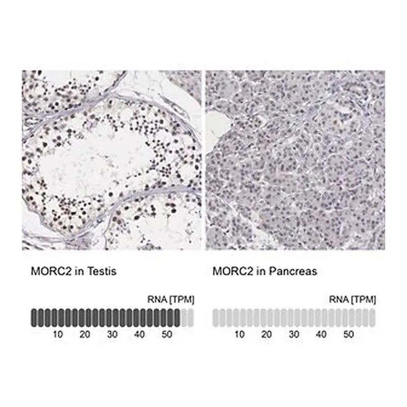 Merck Anti-MORC2 antibody produced in rabbit