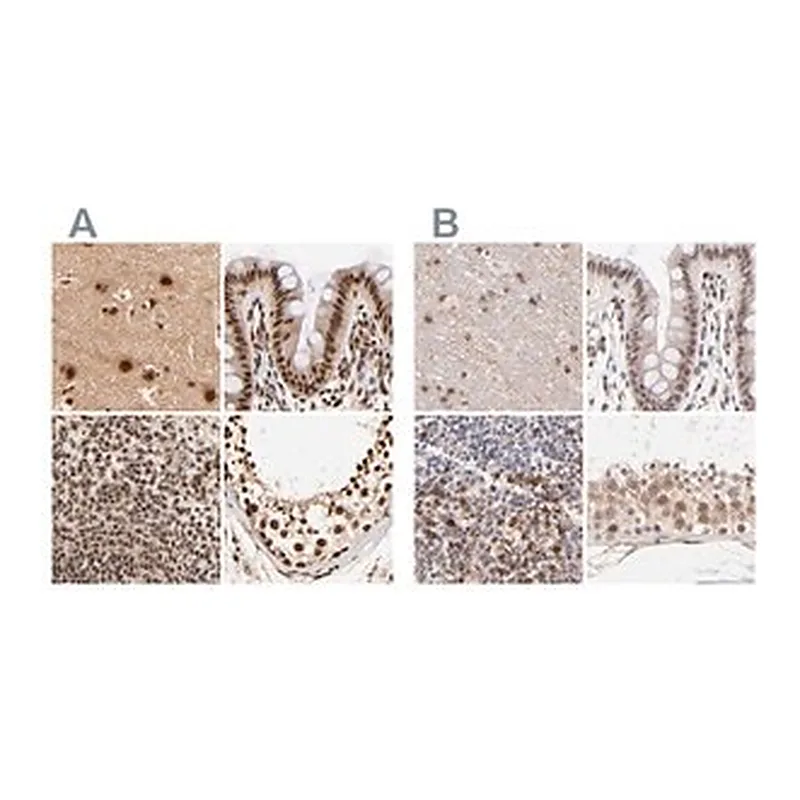 Merck Anti-MED12 antibody produced in rabbit