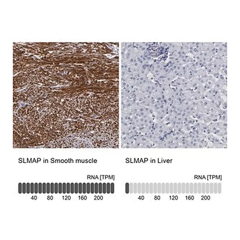 Merck Anti-SLMAP antibody produced in rabbit
