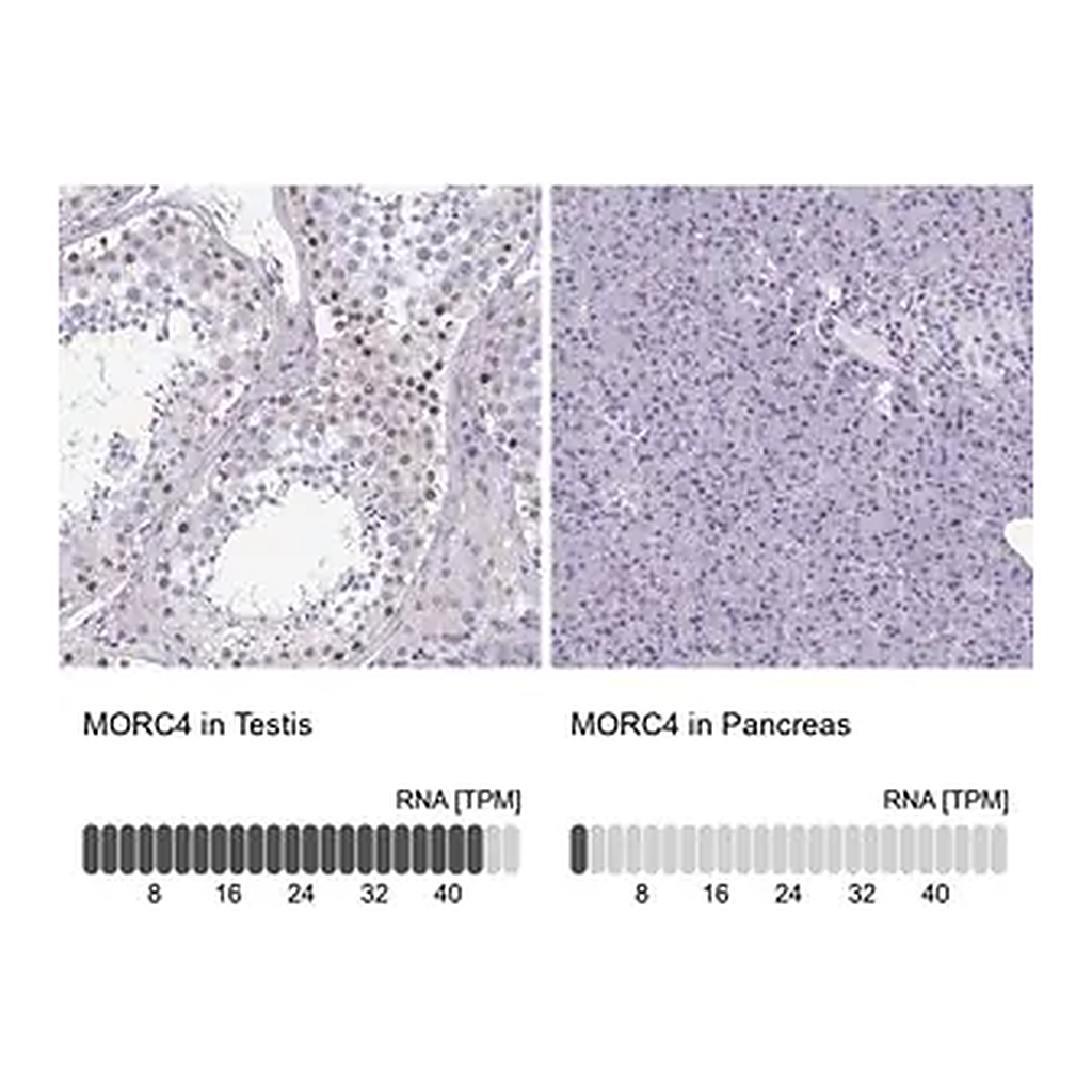 Merck Anti-MORC4 antibody produced in rabbit