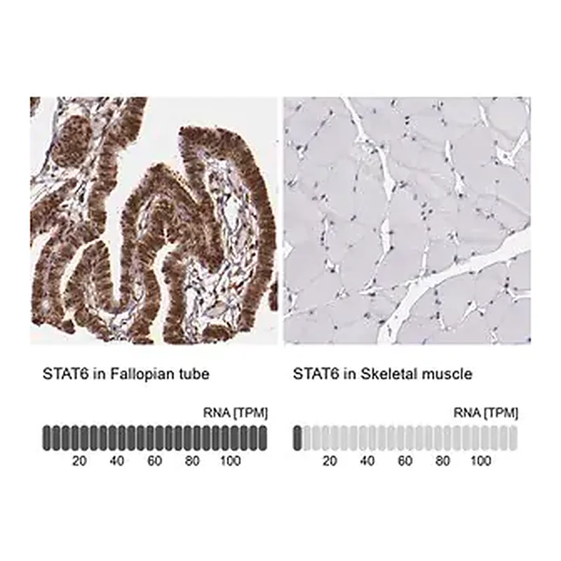 Merck Anti-STAT6 antibody produced in rabbit