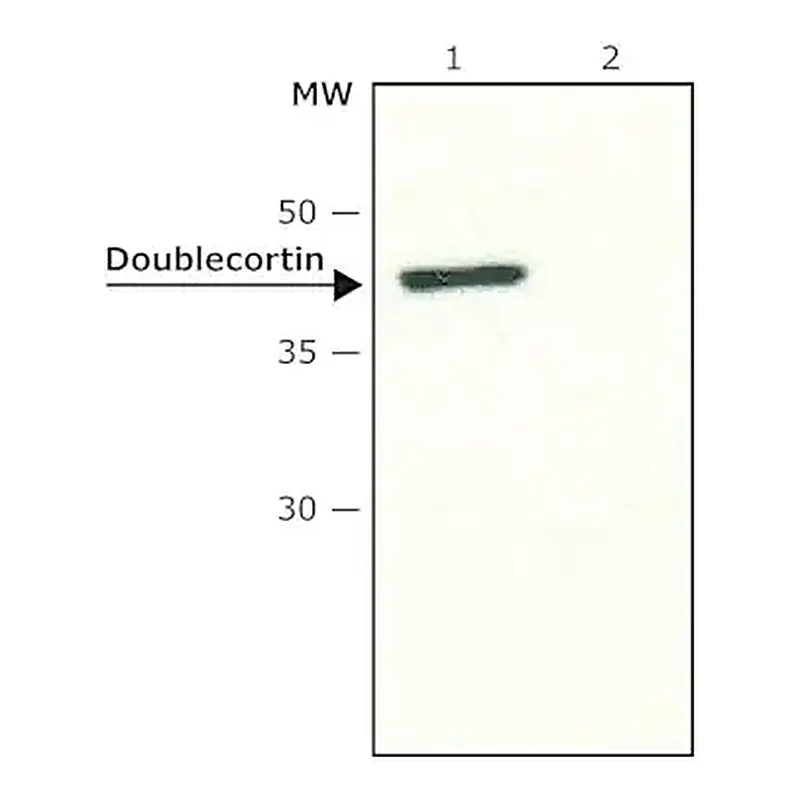 Merck Anti-Doublecortin antibody produced in rabbit