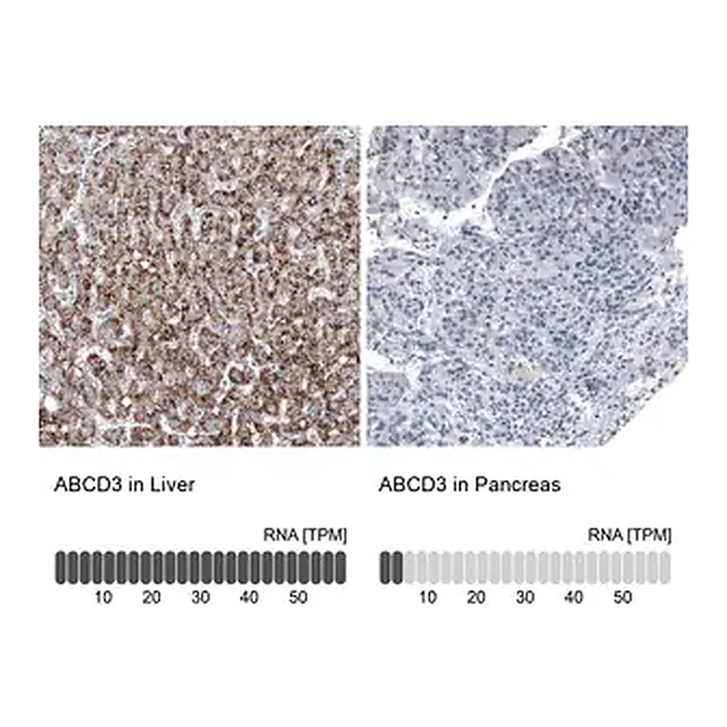 Merck Monoclonal Anti-ABCD3 antibody produced in mouse