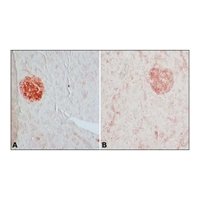 Merck Anti-Glutamic Acid Decarboxylase 65 (5-22) antibody produced in rabbit