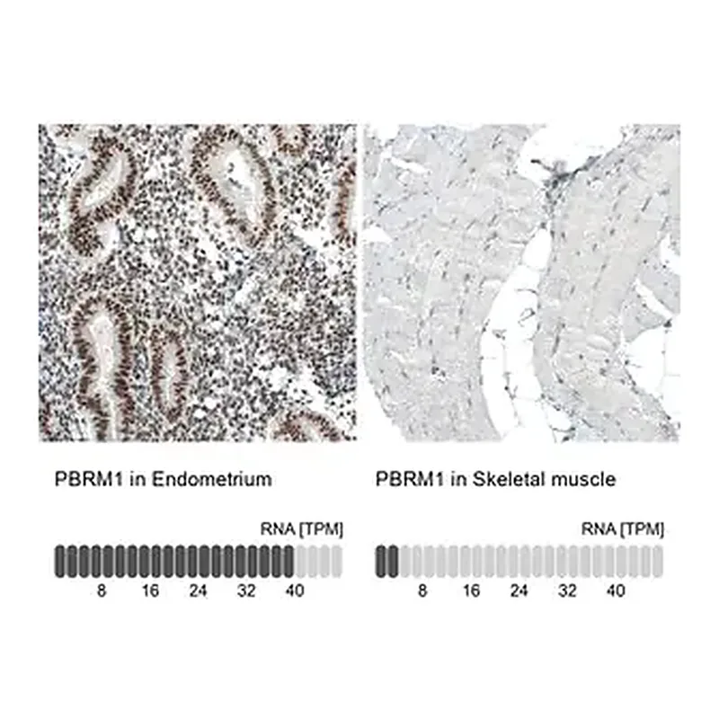 Merck Monoclonal Anti-PBRM1 antibody produced in mouse