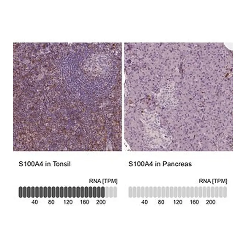 Merck Monoclonal Anti-S100A4 antibody produced in mouse